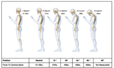 whattextingdoestospine